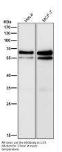 Anti-Smad4 Rabbit Monoclonal Antibody