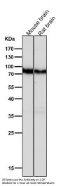 Anti-B Raf Rabbit Monoclonal Antibody