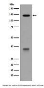 Anti-LDL Receptor Rabbit Monoclonal Antibody