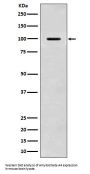 Anti-Amyloid beta A4 APP Rabbit Monoclonal Antibody