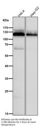 Anti-Amyloid beta A4 APP Rabbit Monoclonal Antibody