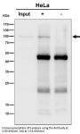 Anti-Amyloid beta A4 APP Rabbit Monoclonal Antibody
