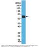 Anti-COX-2 PTGS2 Rabbit Monoclonal Antibody, Clone#RM348