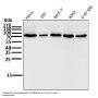 Anti-COX2 PTGS2 Rabbit Monoclonal Antibody