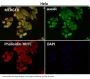 Anti-COX2 PTGS2 Rabbit Monoclonal Antibody