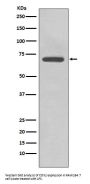 Anti-COX2 PTGS2 Rabbit Monoclonal Antibody
