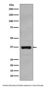 Anti-Rad51 Rabbit Monoclonal Antibody