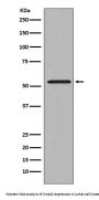 Anti-Smad2 Rabbit Monoclonal Antibody