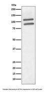 Anti-PML Rabbit Monoclonal Antibody