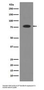 Anti-Transferrin TF Rabbit Monoclonal Antibody