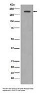 Anti-PDGF Receptor beta PDGFRB Rabbit Monoclonal Antibody