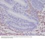 Anti-PDGF Receptor beta PDGFRB Rabbit Monoclonal Antibody