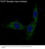 Anti-PDGF Receptor beta PDGFRB Rabbit Monoclonal Antibody