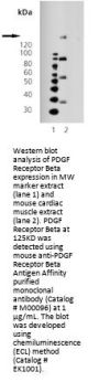 Anti-PDGF Receptor Beta PDGFRB Antibody (Monoclonal, 42G12)
