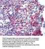 Anti-PDGF Receptor Beta PDGFRB Antibody (Monoclonal, 42G12)