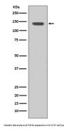 Anti-FGFR1 Rabbit Monoclonal Antibody