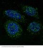 Anti-FGFR1 Rabbit Monoclonal Antibody