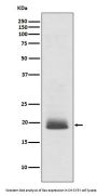 Anti-Ras NRAS Rabbit Monoclonal Antibody
