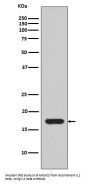 Anti-IL1 beta Rabbit Monoclonal Antibody