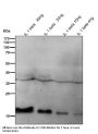 Anti-IL1 beta Rabbit Monoclonal Antibody