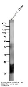 Anti-IL1 beta Rabbit Monoclonal Antibody