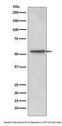 Anti-Src Rabbit Monoclonal Antibody