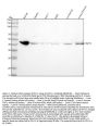 Anti-PD-L1 (CD274) Rabbit Monoclonal Antibody