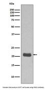 Anti-GTPase HRAS Rabbit Monoclonal Antibody