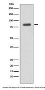 Anti-IKK beta IKBKB Rabbit Monoclonal Antibody