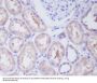 Anti-IKK beta IKBKB Rabbit Monoclonal Antibody