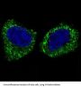 Anti-IKK beta IKBKB Rabbit Monoclonal Antibody