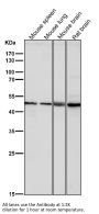 Anti-KLF4/Gklf Rabbit Monoclonal Antibody