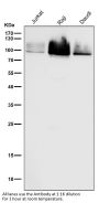 Anti-Cleaved PARP PARP1 Rabbit Monoclonal Antibody