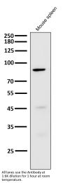 Anti-Cleaved PARP PARP1 Rabbit Monoclonal Antibody