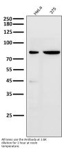 Anti-Cleaved PARP PARP1 Rabbit Monoclonal Antibody