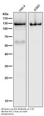 Anti-PARP PARP1 Rabbit Monoclonal Antibody