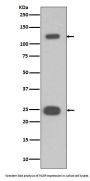 Anti-PARP PARP1 Rabbit Monoclonal Antibody