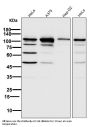 Anti-PARP PARP1 Rabbit Monoclonal Antibody