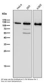 Anti-PARP PARP1 Rabbit Monoclonal Antibody