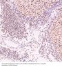 Anti-PARP PARP1 Rabbit Monoclonal Antibody