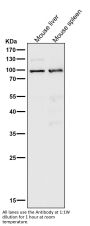 Anti-MLH1 Rabbit Monoclonal Antibody