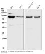 Anti-MLH1 Rabbit Monoclonal Antibody
