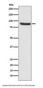 Anti-MLH1 Rabbit Monoclonal Antibody