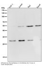 Anti-Parkin PARK2 Rabbit Monoclonal Antibody