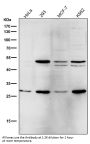 Anti-Parkin PARK2 Rabbit Monoclonal Antibody