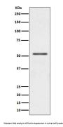 Anti-Parkin PARK2 Rabbit Monoclonal Antibody