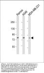 Anti-TLR2 Antibody