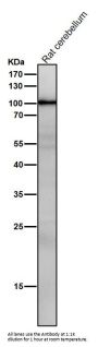 Anti-TLR2 Rabbit Monoclonal Antibody