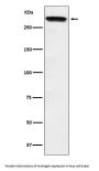 Anti-Huntingtin Monoclonal Antibody