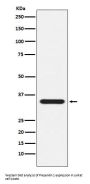 Anti-Presenilin 1 Monoclonal Antibody